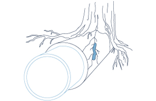 Drainage